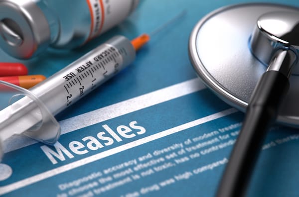 There is a current measles outbreak in the UK. What do we know?